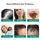 Growth Spray Serum Anti Hair Loss