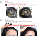 Anti Hair Loss Growth Spray