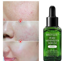 Vitamin C + Shrinking Pore Whitening Freckle Serum Remove Dark Spots