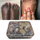 African Black Soap Treatment Acne