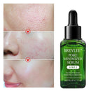 Vitamin C + Shrinking Pore Whitening Freckle Serum Remove Dark Spots