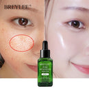 Vitamin C + Shrinking Pore Whitening Freckle Serum Remove Dark Spots