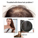 Ginger Anti Hair Loss Shampoo