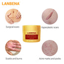 LANBENA Scar Removal Cream