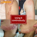 LANBENA Scar Removal Cream