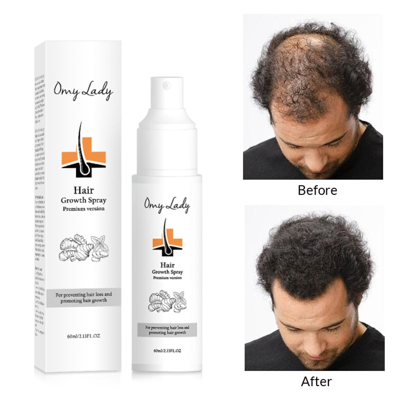 Spray Anti-hair Loss