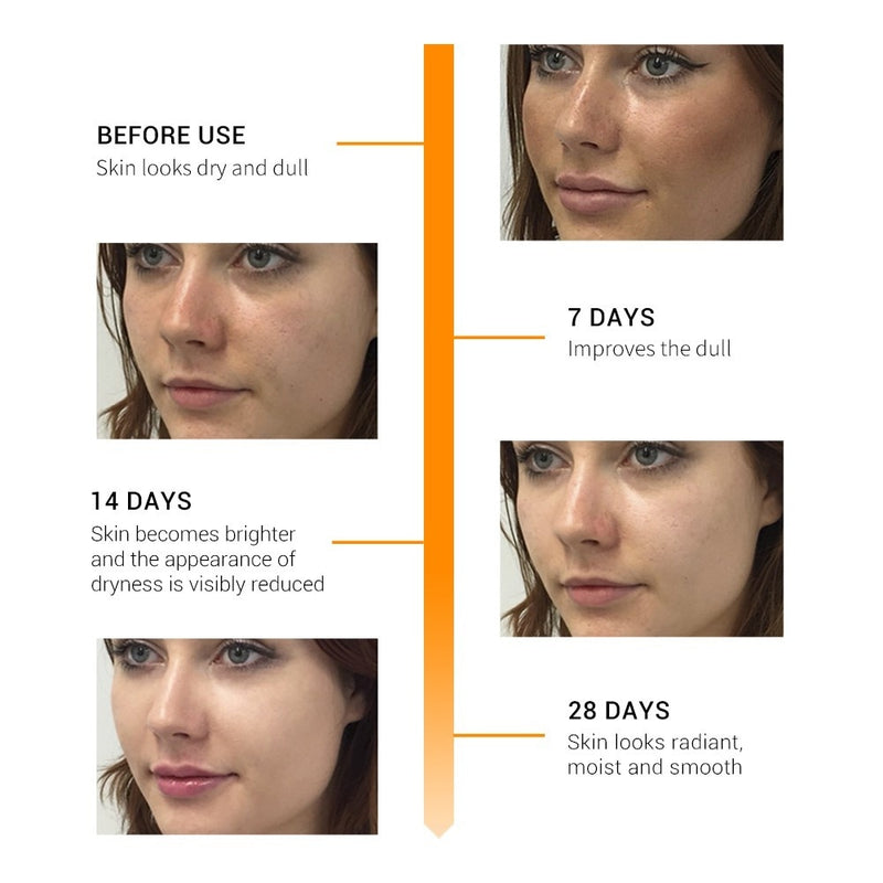 Vitamin C + Shrinking Pore Whitening Freckle Serum Remove Dark Spots