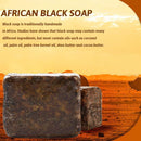 African Black Soap Treatment Acne